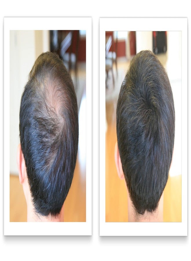 Caboki 10X Volumizing Hair Powder for Thinning Hair: Root Touch Up for Men and Women, Fill in Hairline & Edges, Cover Bald Spots. TALC-Free, Dark Gray - Image 3